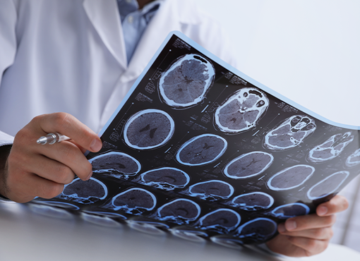 Proving Exacerbation of Pre-Existing Brain Injuries and Conditions