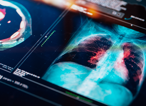 Deposing Doctors, Biomechanics Experts, and More: Exposing Bad Science and Overreach in Personal Injury Litigation